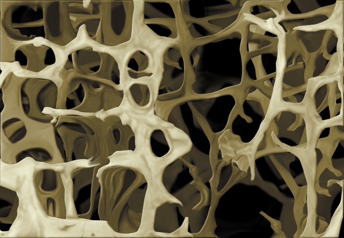 imagen-1b-pagina-262-estructura-hueso-osteoporotico